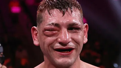 Edgar Berlanga dejó completamente cerrado el ojo del argentino Marcelo Cóceres