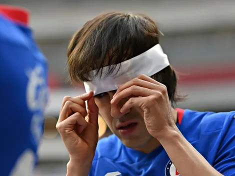 Cruz Azul publicó una foto de la herida de Shaggy Martínez