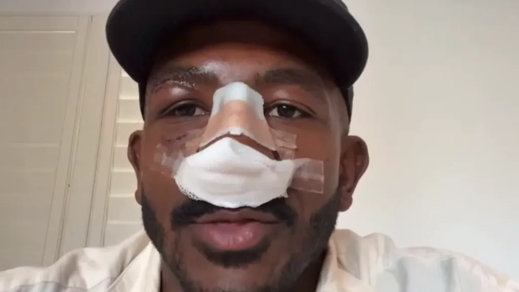 Así quedó el rostro de Khalil Rountree Jr. post pelea vs. Alex Pereira en UFC 307. (CAPTURA DE PANTALLA)