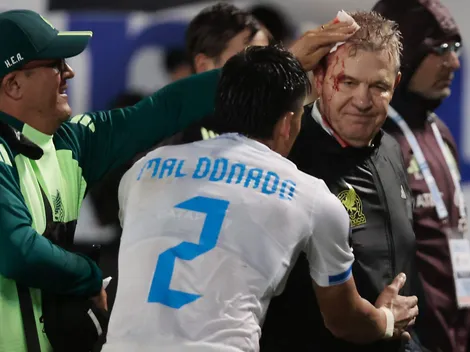 La sanción de Concacaf contra Honduras por la agresión a Javier Aguirre