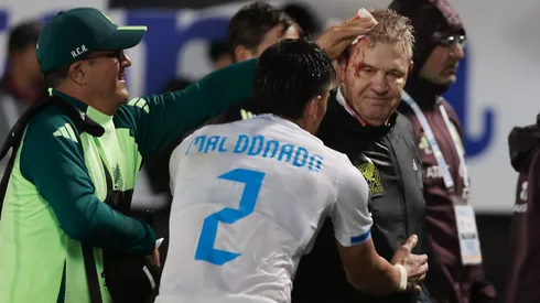 El DT fue golpeado en su cabeza con una lata lanzada desde una de las gradas del Estadio General Francisco Morazán.