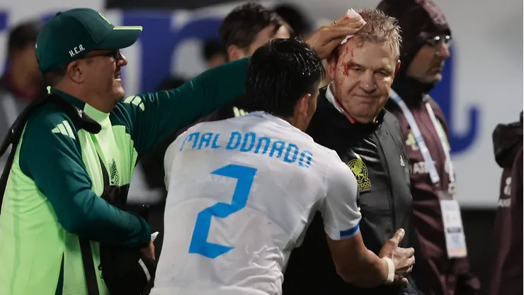El DT fue golpeado en su cabeza con una lata lanzada desde una de las gradas del Estadio General Francisco Morazán.