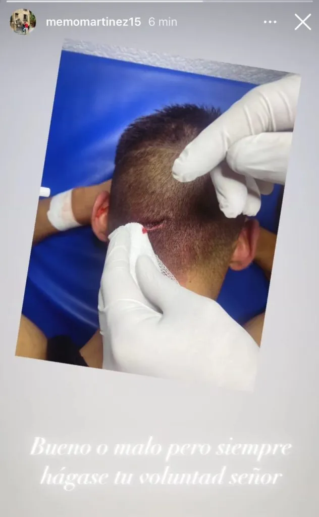 La imagen que compartió ‘Memo’ en su Instagram.