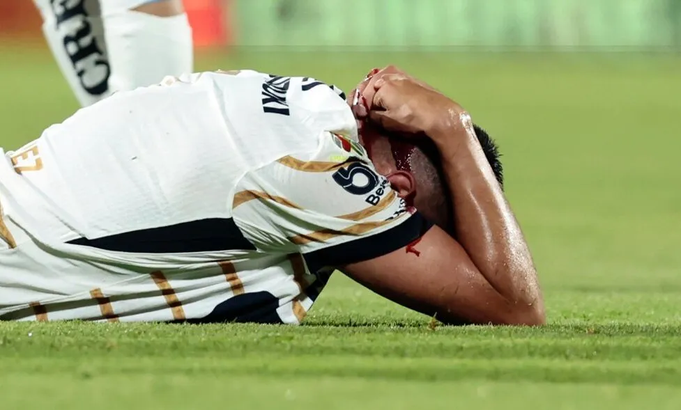 El momento del impacto a ‘Memo’ [Foto: TUDN]