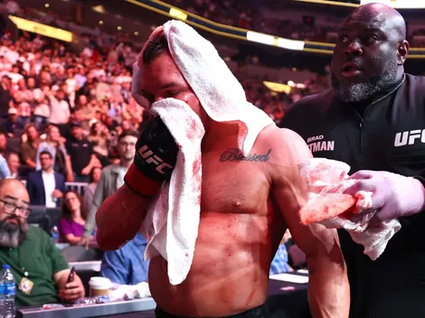 El rostro desfigurado de Michael Chandler tras nocaut vs. Paddy Pimblett en UFC 314