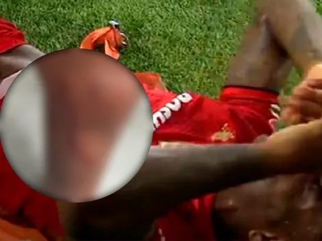 Brutal: Helinho mostró la cicatriz de la patada de Lichnovsky en Toluca-América