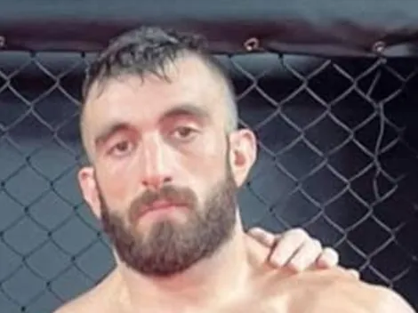 Así quedó el luchador desfigurado de UFC que puso en peligro su ojo