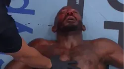 Khalil Rountree Jr. quedó muy herido luego de su pelea ante Jiri Prochazka.