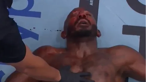Khalil Rountree Jr. quedó muy herido luego de su pelea ante Jiri Prochazka.