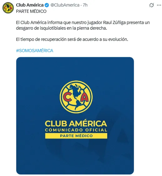 Comunicado del América sobre Raúl Zúñiga