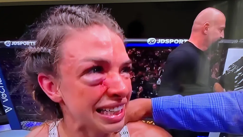 Así de herido terminó el rostro de Mackezie Dern tras la pelea con Virna Jandiroba. (CAPTURA DE PANTALLA)