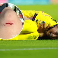 La polémica jugada donde Scarlett Camberos sale herida y expulsada