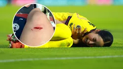 Revelan video de la jugada que lesionó a Scarlett Camberos