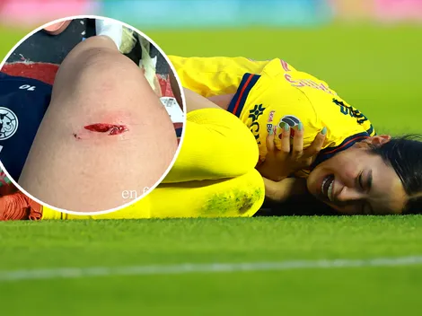 La polémica jugada donde Scarlett Camberos sale herida y expulsada