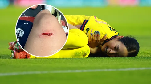 Revelan video de la jugada que lesionó a Scarlett Camberos