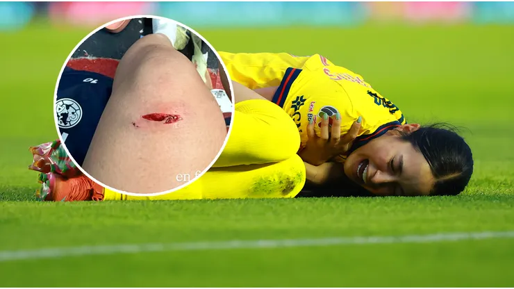 Revelan video de la jugada que lesionó a Scarlett Camberos