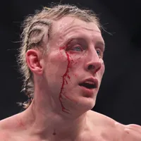 Impactante: así quedó el rostro de Paddy Pimblett tras perder con Justin Gaethje en UFC 324
