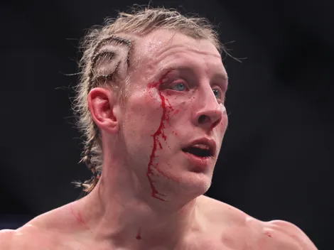 El rostro desfigurado de Paddy Pimblett luego de UFC 324