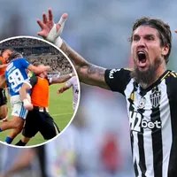 Fue golpeado por 7 jugadores de Cruzeiro y así quedó su rostro