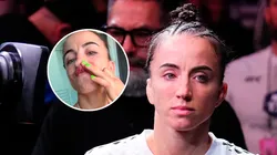 Maycee Barber mostró cómo quedó su rostro