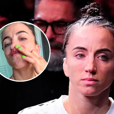 El video que muestra cómo quedó Maycee Barber tras brutal nocaut de Alexa