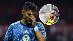El rostro de Sebastián Cáceres tras el golpe.