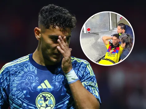 Así quedó el rostro de Sebastián Cáceres tras el fuerte choque con Álvaro Ángulo