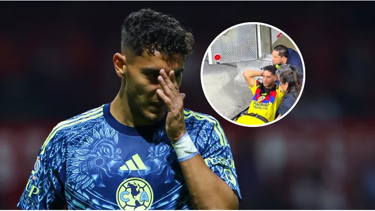 El rostro de Sebastián Cáceres tras el golpe.