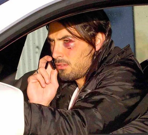 Dudu Aouate terminó gravemente herido luego de pelearse con Gustavo Munúa. (X)