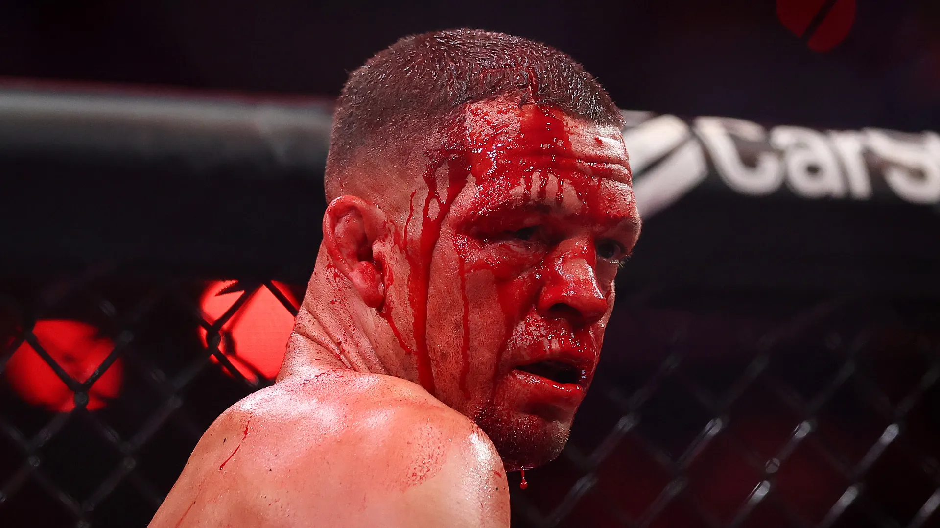 Nate Diaz sufrió un duro castigo por parte de Mike Perry. (GETTY IMAGES)