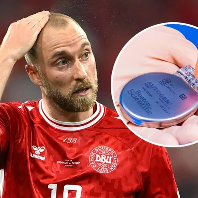 Qué es el DAI, dispositivo que salvó a Eriksen de otro paro cardíaco severo
