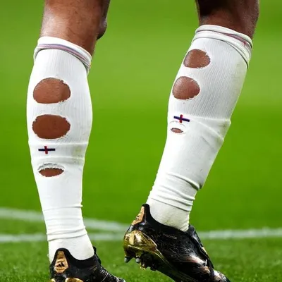 ¿Moda o ventaja? La razón detrás de las "medias rotas" de los futbolistas