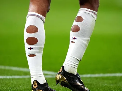 ¿Moda o ventaja? La razón detrás de las "medias rotas" de los futbolistas