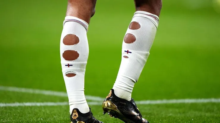 Las medias 'rotas', un caso reiterado en el futbol.