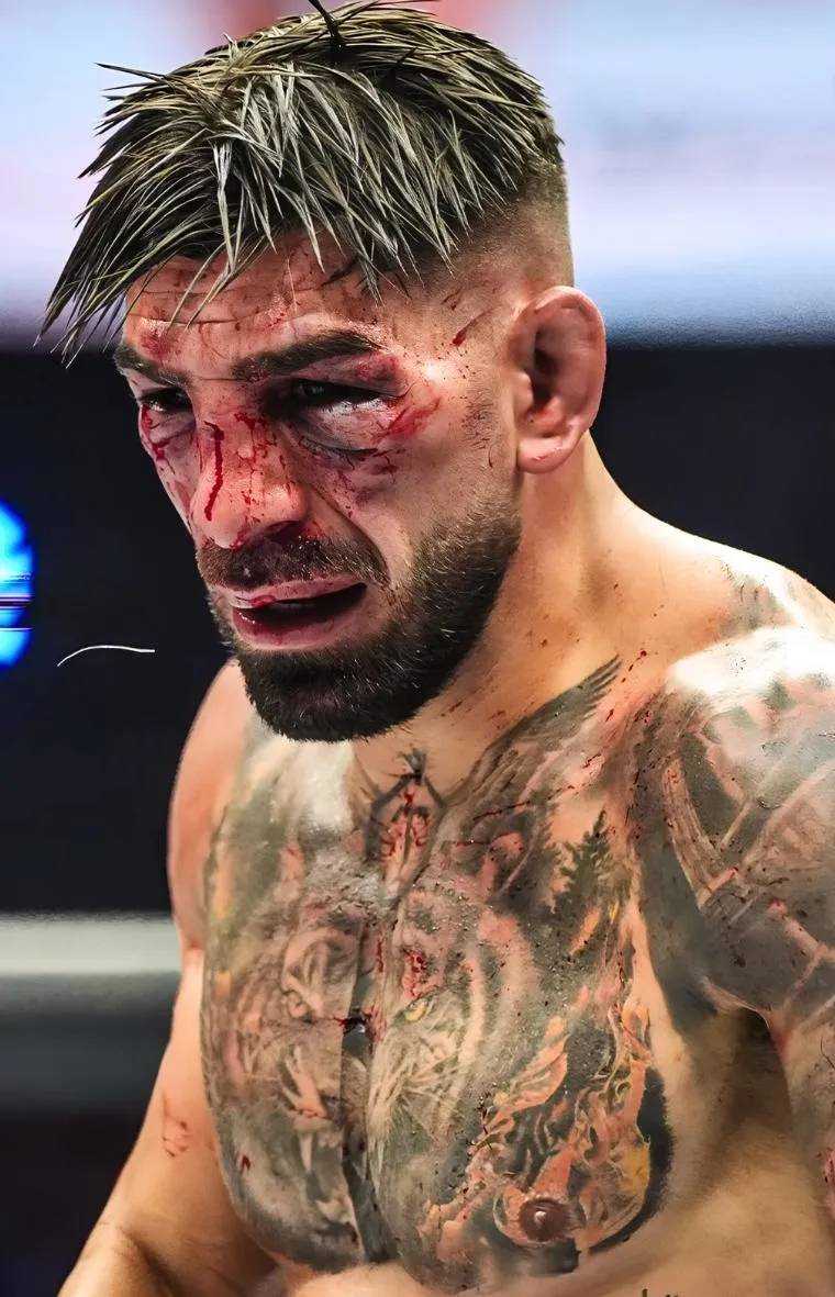 Así terminó el rostro de Ilia Topuria en UFC Casa Blanca. (INSTAGRAM PRIMER ASALTO)