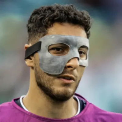 ¿Por qué Sebastián Cáceres juega con protector en la cara?