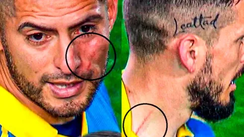 Zambrano sobre su "venganza" contra Benedetto: "Fue con lágrimas"