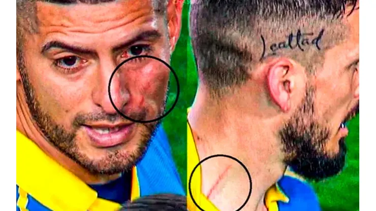 Zambrano sobre su "venganza" contra Benedetto: "Fue con lágrimas"