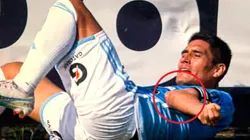 Irven Ávila sufrió luxación al codo izquierdo (VIDEO)