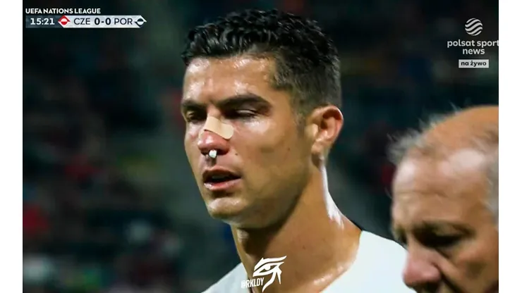 ¡Lleno de sangre! Así quedó el rostro de Cristiano tras fuerte choque. (Foto: Captura de video)