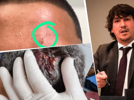 Jean Ferrari denuncia agresiones contra integrantes de Universitario de Deportes