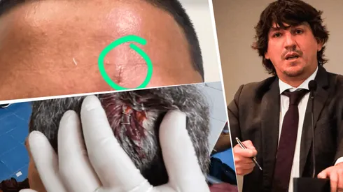 Jean Ferrari denuncia agresiones contra integrantes de Universitario de Deportes