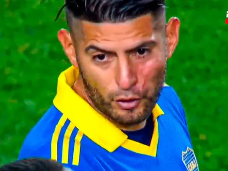 Carlos Zambrano volvió al campo con el rostro golpeado