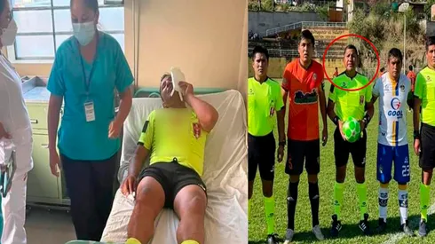 Un hecho lamentable volvió a sucitarse en la Copa Perú. Foto: GLR