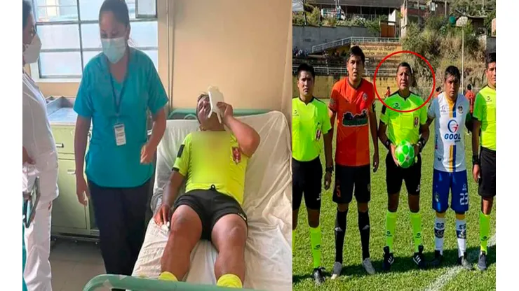 Un hecho lamentable volvió a sucitarse en la Copa Perú. Foto: GLR