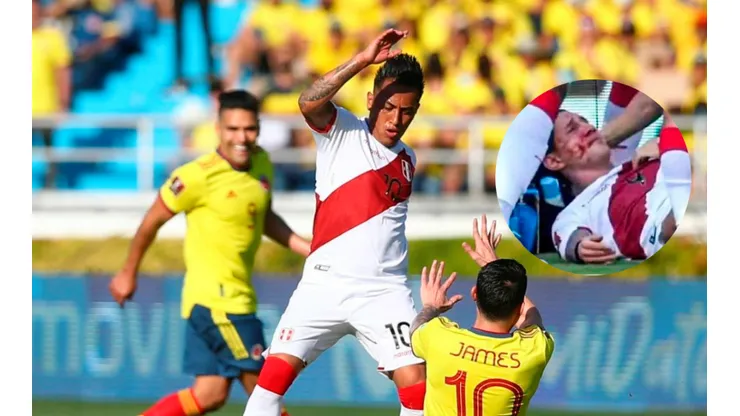 Christian Cueva pide que no golpeen a Gianluca Lapadula: "Lo están desfigurando"