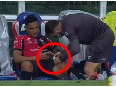 Santamaría salió lesionado en duelo entre Atlas y Chivas, y preocupa en la Selección Peruana