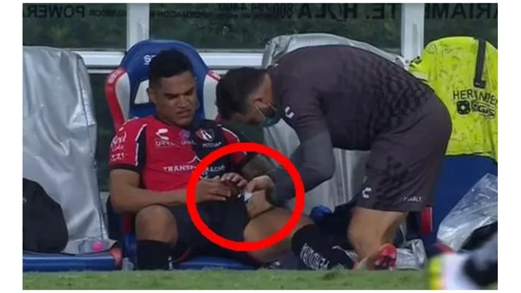 Santamaría salió lesionado en duelo entre Atlas y Chivas, y preocupa en la Selección Peruana