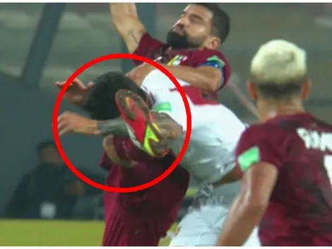 Gianluca Lapadula terminó ensangrentado tras terrible rodillazo de Tomás Rincón