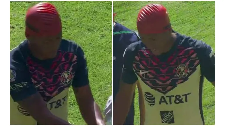 ¡Pudo haber sido una tragedia! Aquino uso gorro de nado tras un choque de cabezas con Cáceres